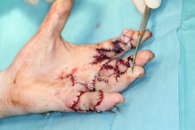 Aspecto tras la cirugía